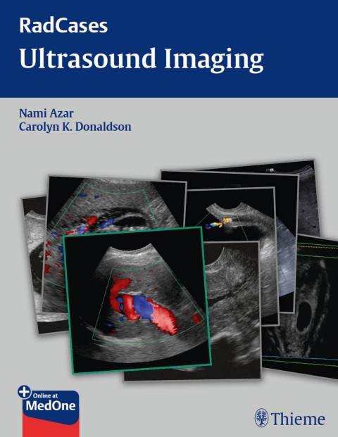 Cover image for book Radcases Ultrasound Imaging