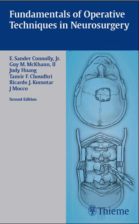 Cover image for book Fundamentals of Operative Techniques in Neurosurgery