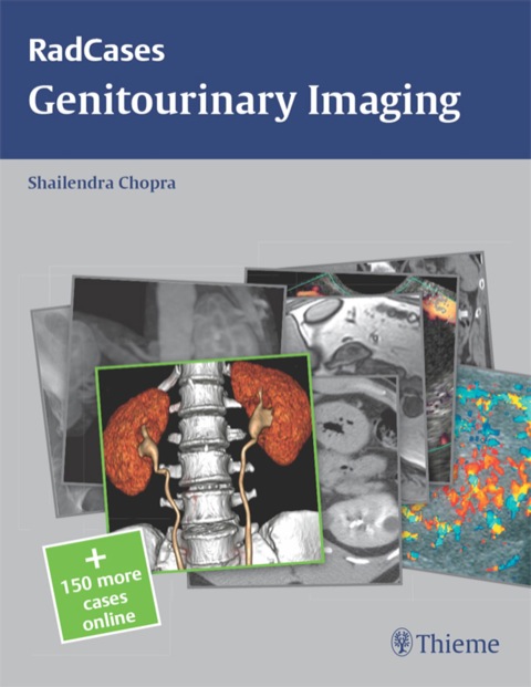 Cover image for book Radcases Genitourinary Imaging