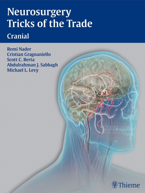 Cover image for book Neurosurgery Tricks of the Trade - Cranial