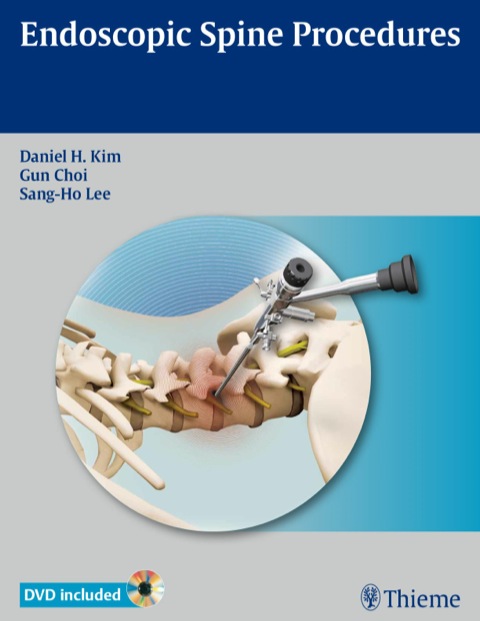 Cover image for book Endoscopic Spine Procedures