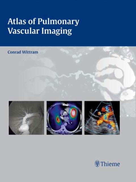Cover image for book Atlas of Pulmonary Vascular Imaging