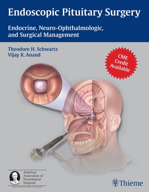 Cover image for book Endoscopic Pituitary Surgery