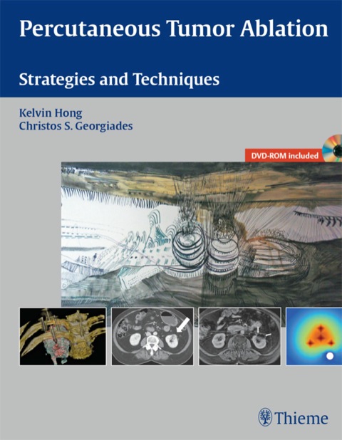 Cover image for book Percutaneous Tumor Ablation