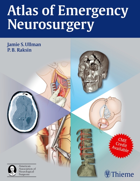Cover image for book Atlas of Emergency Neurosurgery