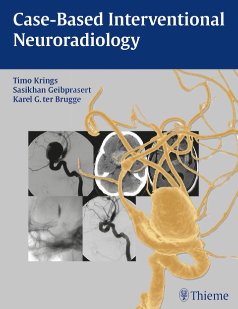 Cover image for book Case-Based Interventional Neuroradiology
