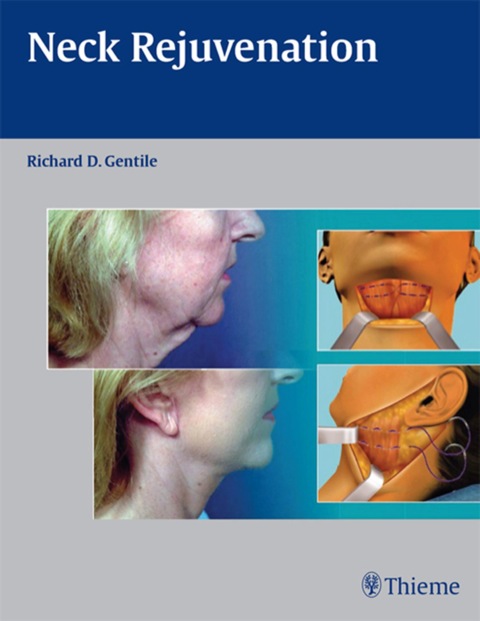 Cover image for book Neck Rejuvenation