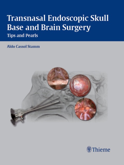 Cover image for book Transnasal Endoscopic Skull Base and Brain Surgery