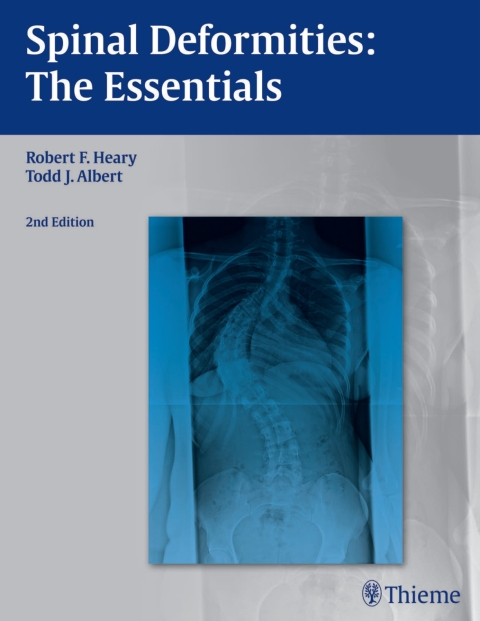 Cover image for book Spinal Deformities