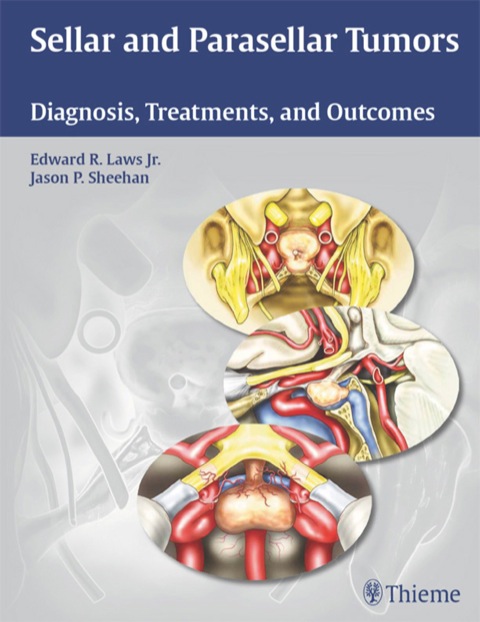 Sellar and Parasellar Tumors 
