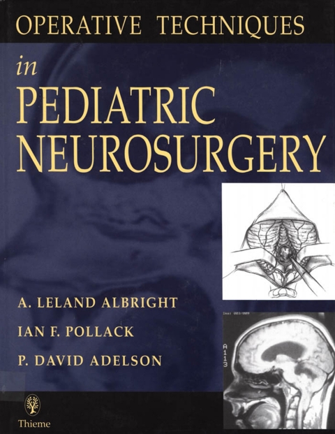 Operative Techniques in Pediatric Neurosurgery 