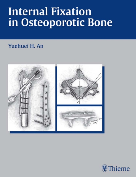 Cover image for book Internal Fixation in Osteoporotic Bone