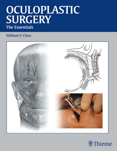 Cover image for book Oculoplastic Surgery