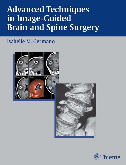 Cover image for book Advanced Techniques in Image-Guided Brain and Spine Surgery