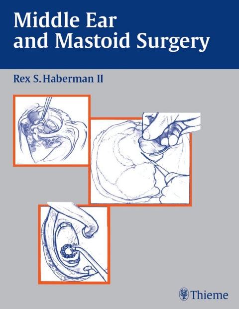 Cover image for book Middle Ear and Mastoid Surgery
