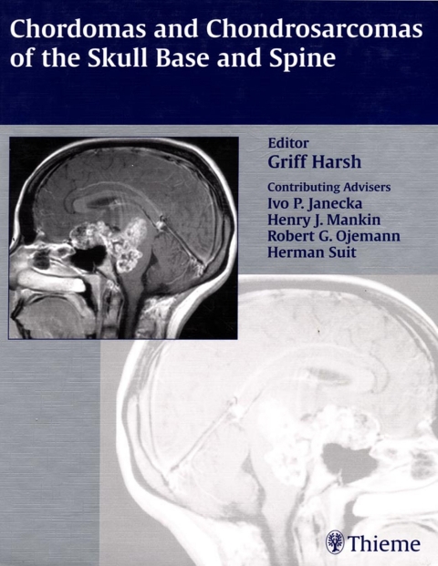 Cover image for book Chordomas and Chondrosarcomas of the Skull Base and Spine
