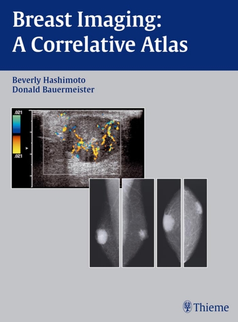 Cover image for book Breast Imaging