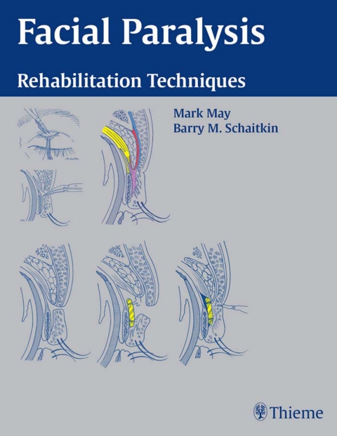Cover image for book Facial Paralysis