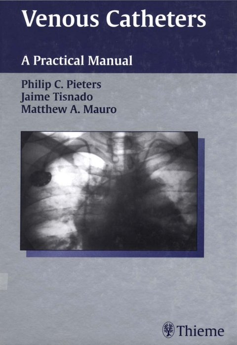 Cover image for book Venous Catheters