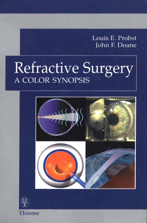 Cover image for book Refractive Surgery