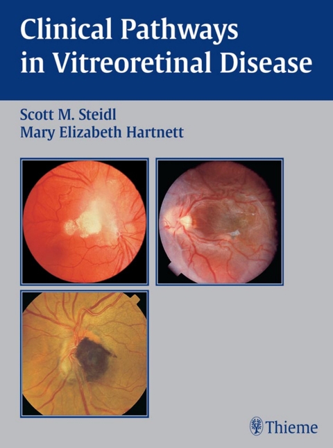 Cover image for book Clinical Pathways In Vitreoretinal Disease