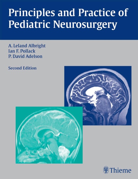 Principles and Practice of Pediatric Neurosurgery 