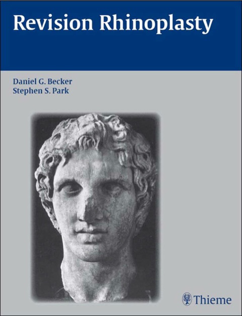 Cover image for book Revision Rhinoplasty
