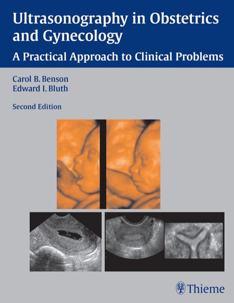 Cover image for book Ultrasonography in Obstetrics and Gynecology