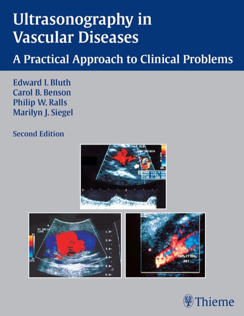 Ultrasonography in Vascular Diseases 