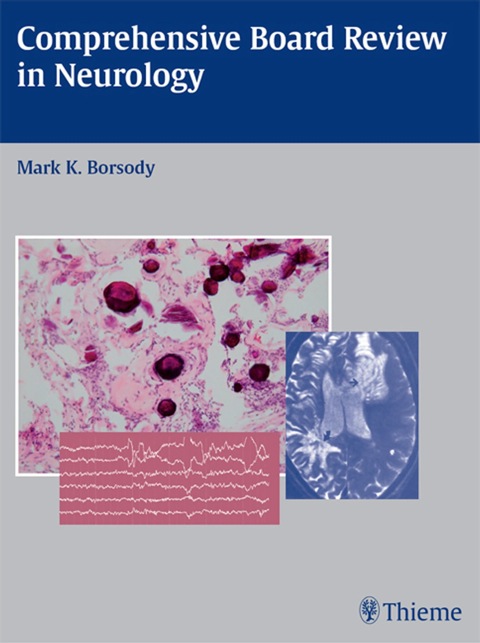 Cover image for book Comprehensive Board Review in Neurology