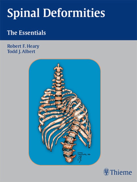 Cover image for book Spinal Deformities: The Essentials