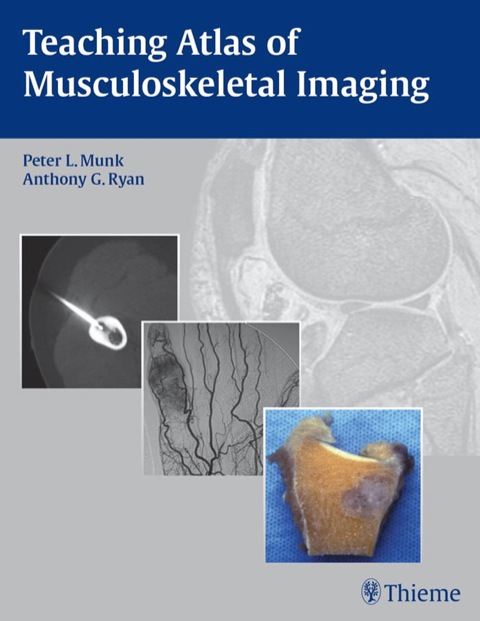 Cover image for book Teaching Atlas of Musculoskeletal Imaging