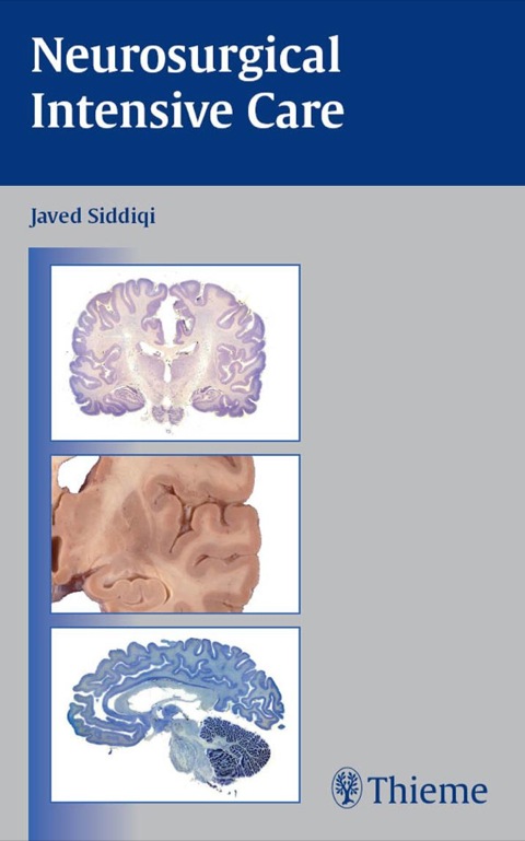 Cover image for book Neurosurgical Intensive Care