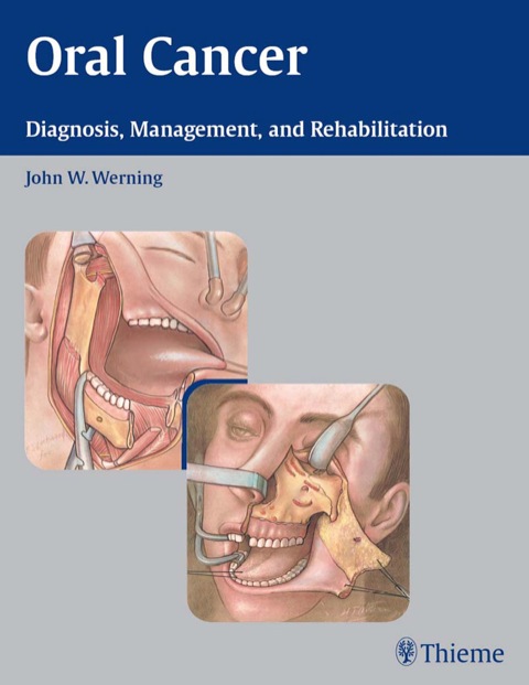 Cover image for book Oral Cancer