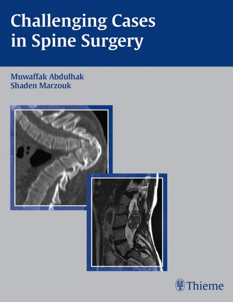 Cover image for book Challenging Cases in Spine Surgery