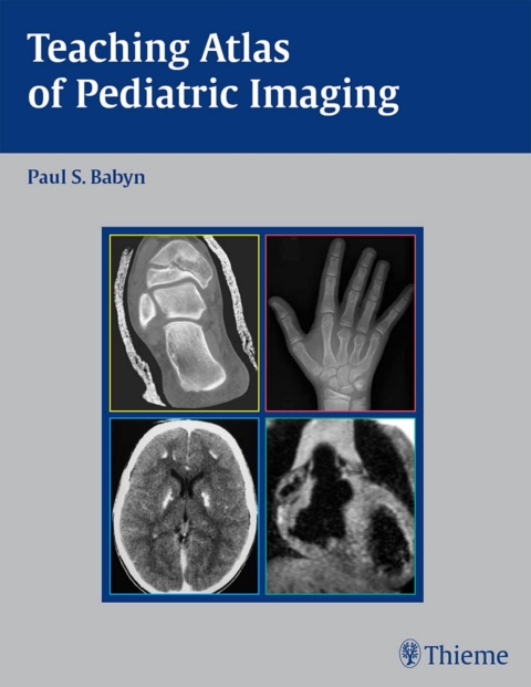 Cover image for book Teaching Atlas of Pediatric Imaging