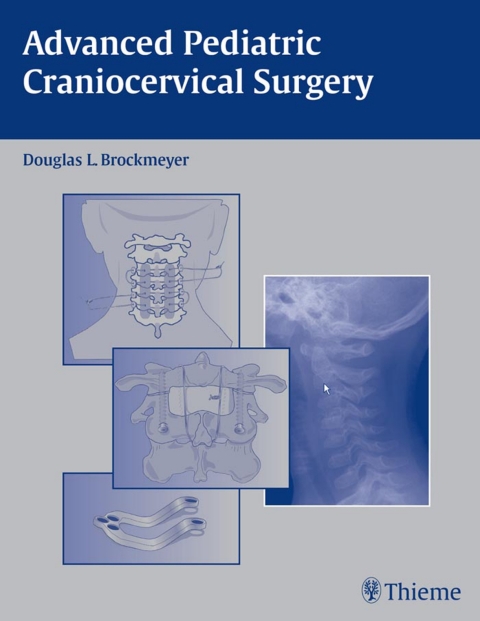 Cover image for book Advanced Pediatric Craniocervical Surgery