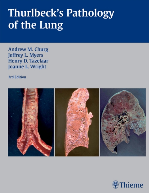 Cover image for book Thurlbeck's Pathology of the Lung