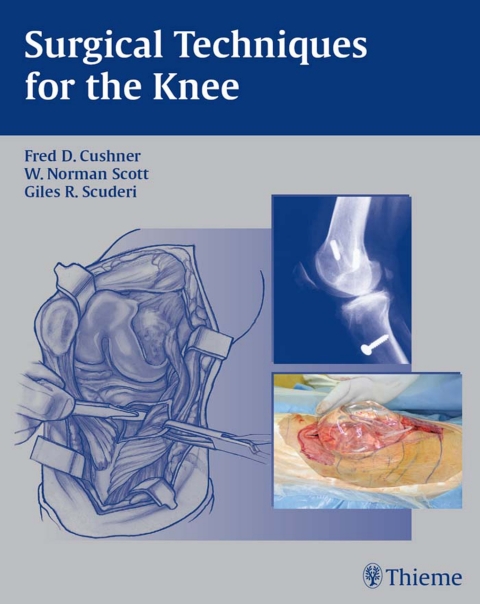 Cover image for book Surgical Techniques for the Knee