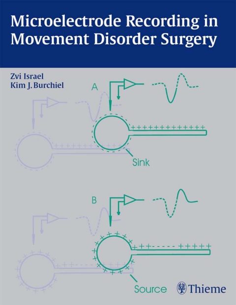 Cover image for book Microelectrode Recording in Movement Disorder Surgery