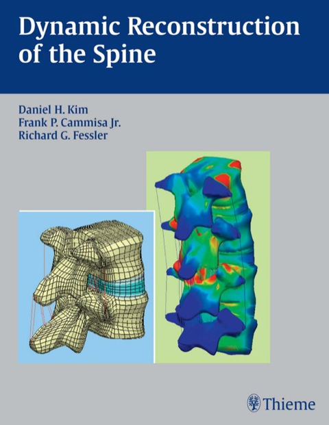 Cover image for book Dynamic Reconstruction of the Spine