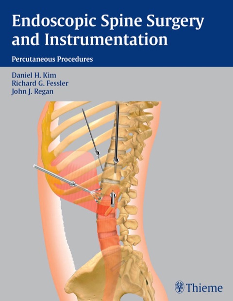 Cover image for book Endoscopic Spine Surgery and Instrumentation