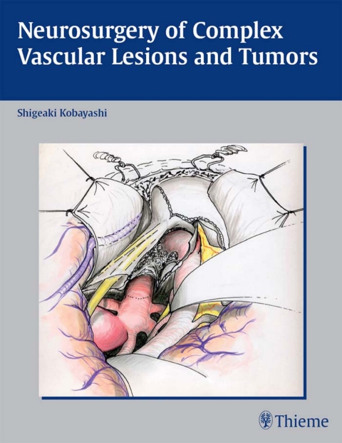 Cover image for book Neurosurgery of Complex Vascular Lesions and Tumors