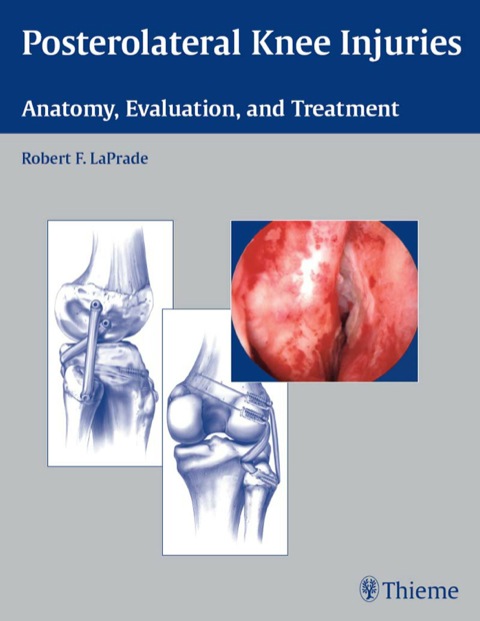 Cover image for book Posterolateral Knee Injuries