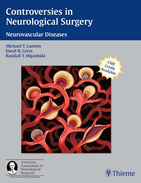 Cover image for book Controversies in Neurological Surgery