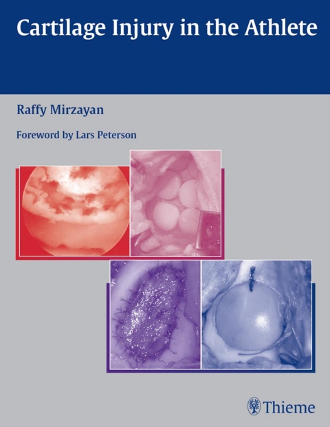 Cover image for book Cartilage Injury in the Athlete