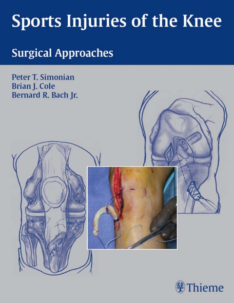 Cover image for book Sports Injuries of the Knee