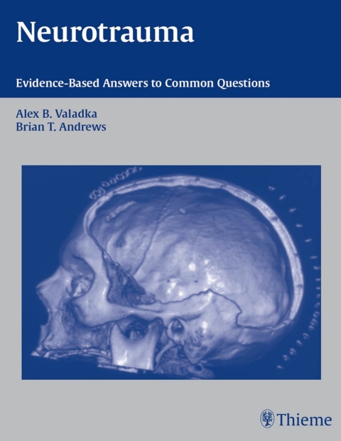 Cover image for book Neurotrauma