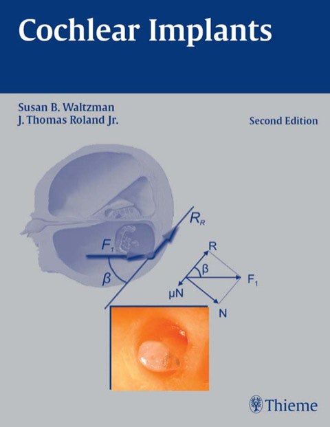 Cover image for book Cochlear Implants