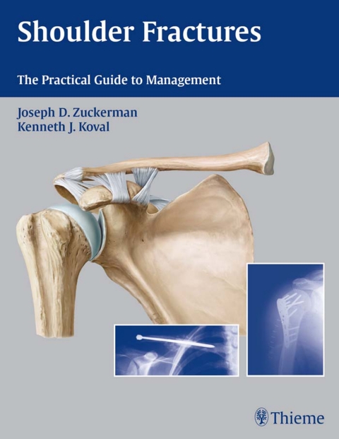 Cover image for book Shoulder Fractures